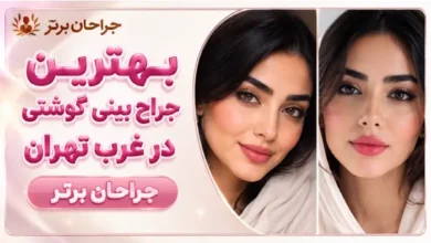 تصویر از بهترین جراح بینی گوشتی در غرب تهران