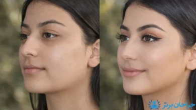 تصویر از بهترین جراح ترمیمی بینی