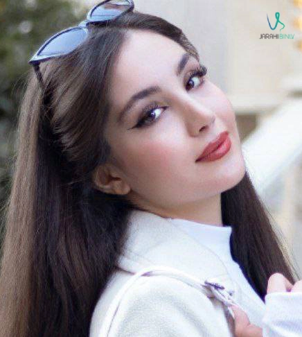 نمونه کار جراحی بینی دکتر آرزو خوانسارینیا ۳ | بهترین جراح بینی در تهران