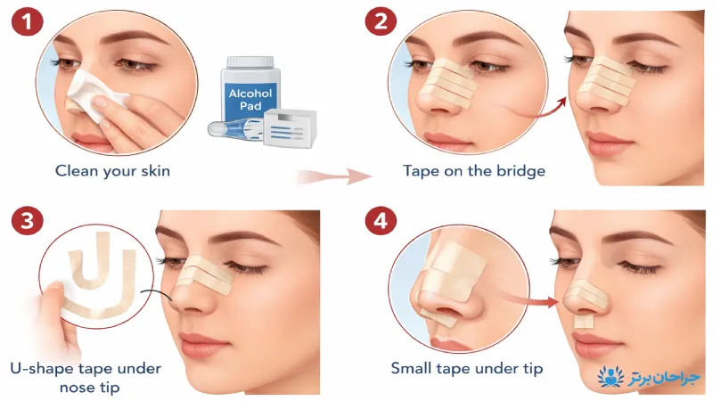 آموزش تصویری چسب زدن بینی