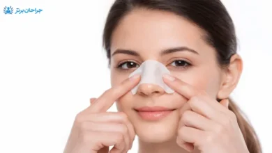 تصویر از نحوه چسب زدن بینی