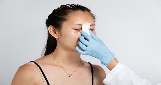 جراحی بینی باز بهتر است یا جراحی بینی بسته؟