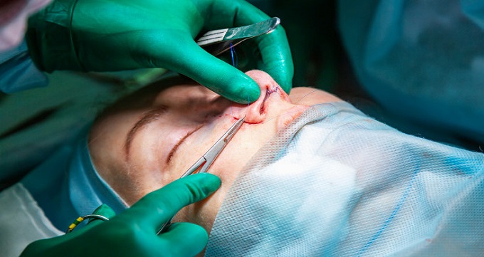 روش های انجام جراحی بینی استخوانی