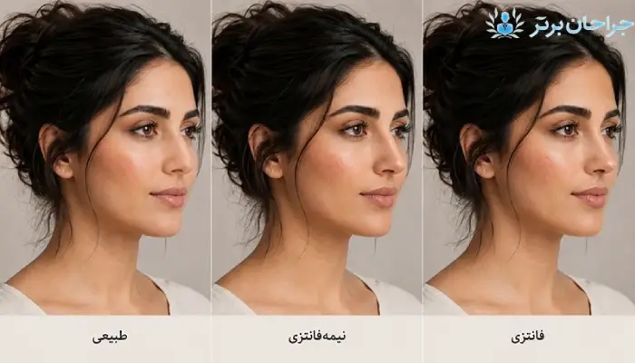 تفاوت جراحی بینی طبیعی با فانتزی و نیمه فانتزی