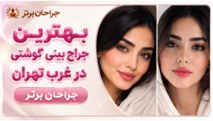 بهترین جراح بینی گوشتی در غرب تهران- جراحان برتر