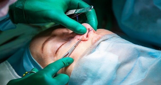 اقدامات بعد از جراحی بینی