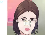 تصویر از توضیحاتی در مورد مراقبت پرستاری جراحی بینی