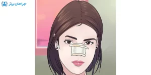 مراقبت پرستاری عمل بینی