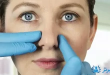 تصویر از آیا جراحی بینی بدون بیهوشی وجود دارد؟