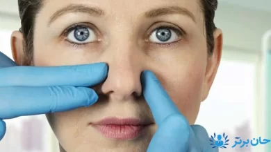 تصویر از آیا جراحی بینی بدون بیهوشی وجود دارد؟