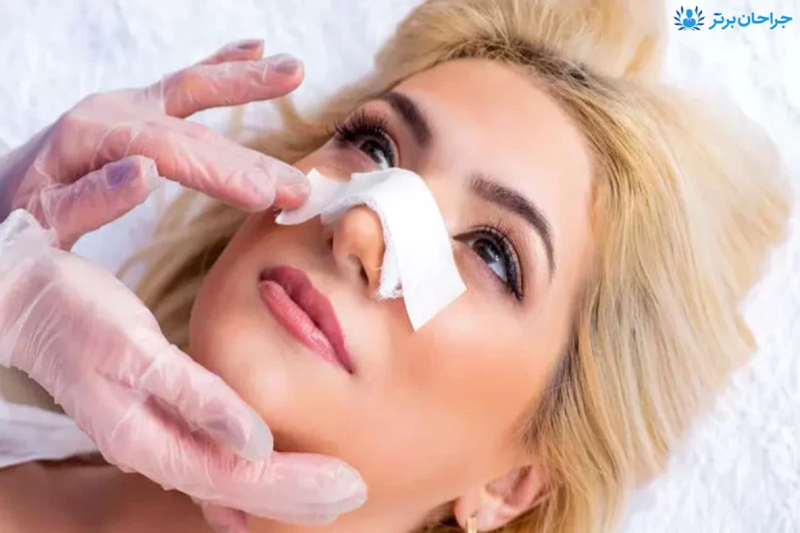 چرا نباید بلافاصله بعد از عمل بینی فین کنیم؟