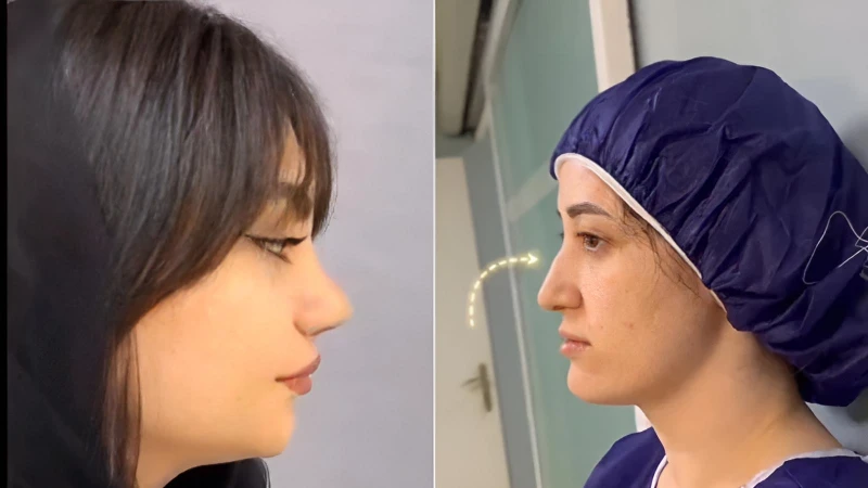 نمونهکار دکتر علی شکرریز؛ اصلاح پهنی و تقارن سوراخها؛ نتیجه طبیعی