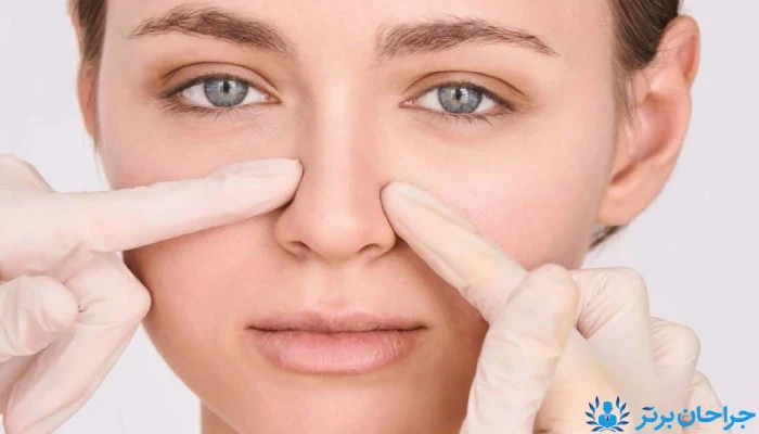 عمل بینی با پوست ضخیم با هدف ایجاد فرم طبیعی و متناسب